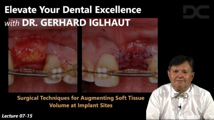 Surgical techniques for augmenting soft tissue volume at implant sites 